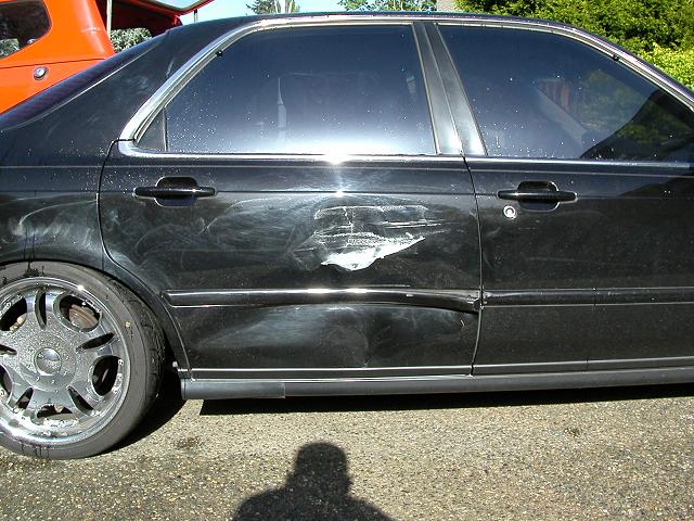 dent.jpg